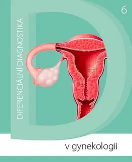 Gynekológia a pôrodníctvo Diferenciální diagnostika v gynekologii - Petr Herle