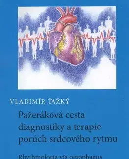 Medicína - ostatné Pažeráková cesta diagnostiky a terapie porúch srdcového rytmu - Vladimír Ťažký