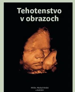 Tehotenstvo a pôrod Tehotenstvo v obrazoch - MUDr. Michal Holáň,Kolektív autorov