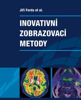 Medicína - ostatné Inovativní zobrazovací metody - Jiří Ferda