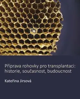 Medicína - ostatné Příprava rohovky pro transplantaci - Kateřina Jirsová