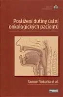 Onkológia Postižení dutiny ústní onkologických pacientů - Kolektív autorov,Samuel Vokurka