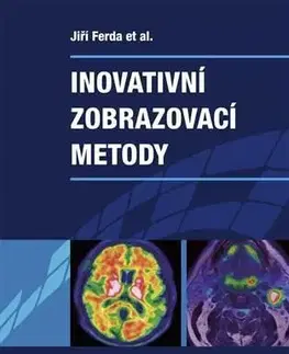 Medicína Inovativní zobrazovací metody - Jiří Ferda