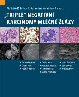Onkológia „Triple“ negativní karcinomy mléčné žlázy - Kolektív autorov