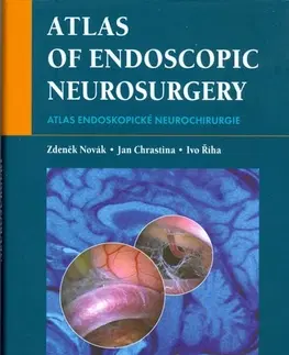 Chirurgia, ortopédia, traumatológia Atlas endoskopické neurochirurgie - Pavel Chrastina,Zdeněk Novák,Ivo Říha