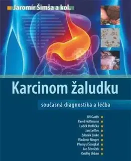 Medicína - ostatné Karcinom žaludku - Jaromír Šimša,Kolektív autorov