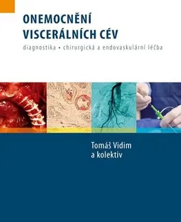 Medicína - ostatné Onemocnění viscerálních cév - Kolektív autorov,Tomáš Vidim