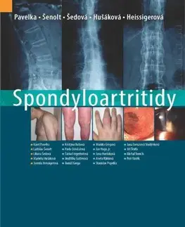 Medicína - ostatné Spondyloartritidy - Kolektív autorov,Karel Pavelka,Ladislav Šenolt