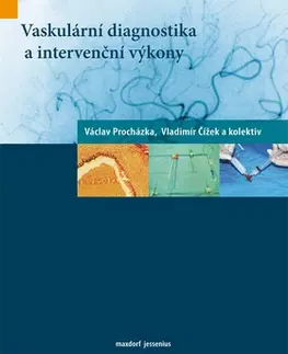 Medicína - ostatné Vaskulární diagnostika a intervenční výkony - Vladimír Čížek,Václav Procházka
