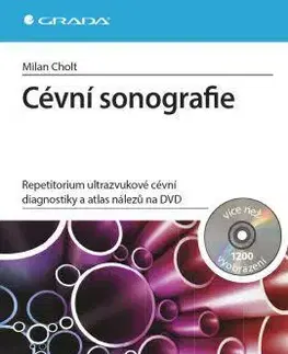 Medicína - ostatné Cévní sonografie + DVD - Milan Cholt
