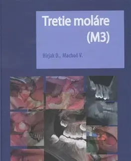 Stomatológia Tretie moláre (M3) - Vladimír Machoň,Dušan Hirjak