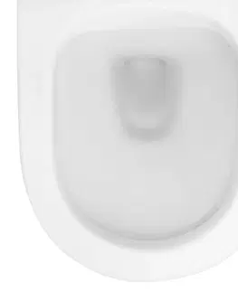 Záchody GEBERIT KOMBIFIXBasic vr. bieleho  tlačidla DELTA 21 + WC REA Carlo Flat Mini Rimlesss + SEDADLO 110.100.00.1 21BI CF1