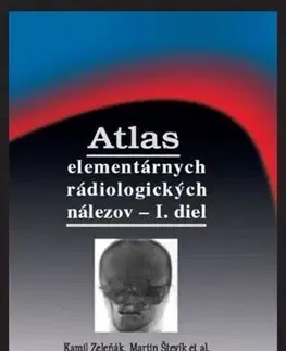 Medicína - ostatné Atlas elementárnych rádiologických nálezov - I. diel - Kamil Zeleňák,Martin Števík
