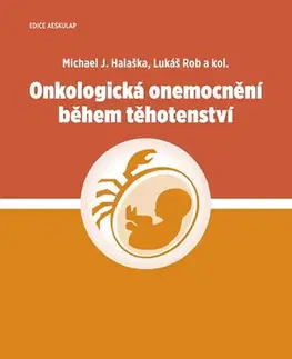 Onkológia Onkologická onemocnění během těhotenství - Kolektív autorov