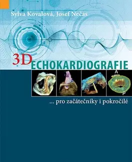 Medicína - ostatné 3D Echokardiografie - Josef Nečas,Sylva Kovalová