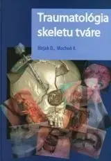 Medicína - ostatné Traumatológia skeletu tváre - Dušan Hirjak,Vladimír Machoň