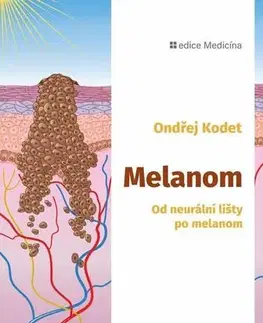 Onkológia Melanom: Od neurální lišty po melanom - Ondřej Kodet