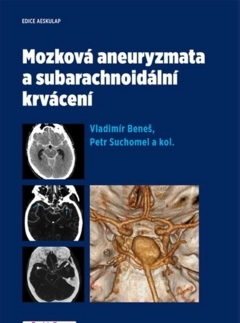 Medicína - ostatné Mozková aneurysmata a subarachnoidální krvácení - Vladimír Beneš