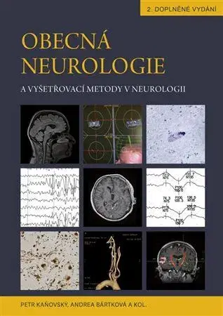 Medicína - ostatné Obecná neurologie a vyšetřovací metody v neurologii - Andrea Bártková,Kolektív autorov,Petr Kaňovský