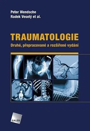 Chirurgia, ortopédia, traumatológia Traumatologie (Druhé, přepracované a rozšířené vydání) - Kolektív autorov,Radek Veselý,Peter Wendsche