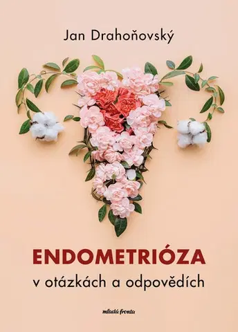 Medicína - ostatné Endometrióza v otázkách a odpovědích - Jan Drahoňovský