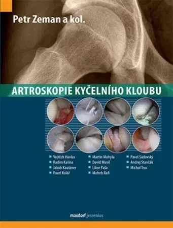 Chirurgia, ortopédia, traumatológia Artroskopie kyčelního kloubu - Petr Zeman