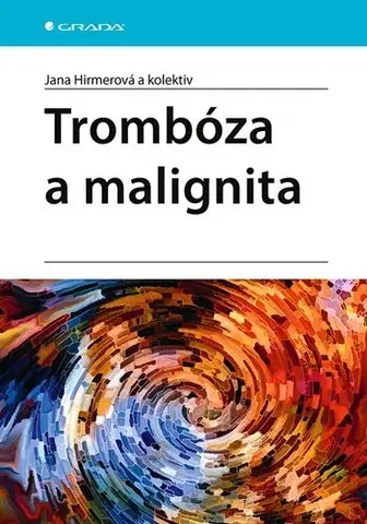 Onkológia Trombóza a malignita - Jana Hirmerová,Kolektív autorov