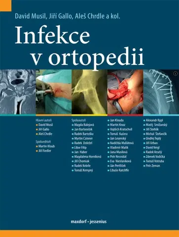 Medicína - ostatné Infekce v ortopedii - Kolektív autorov
