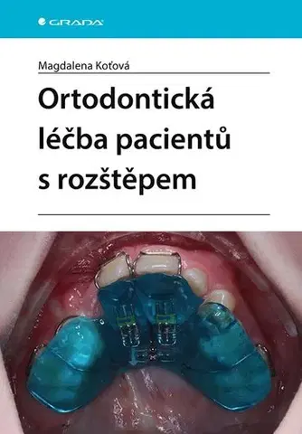 Medicína - ostatné Ortodontická léčba pacientů s rozštěpem - Magdalena Koťová