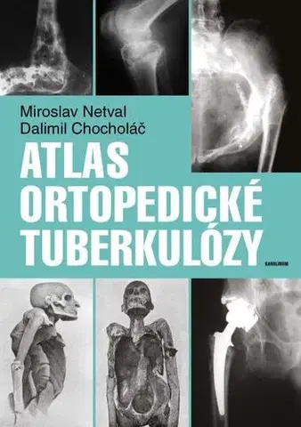Medicína - ostatné Atlas ortopedické tuberkulózy - Dalimil Chocholac,Miroslav Netval