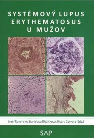 Medicína - ostatné Systémový lupus erythematosus u mužov - Jozef Rovenský