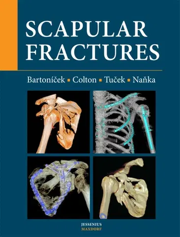 Chirurgia, ortopédia, traumatológia Scapular fractures - Kolektív autorov