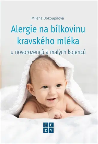 Alergológia, imunológia Alergie na bílkoviny kravského mléka u novorozenců a malých kojenců - Milena Dokoupilova