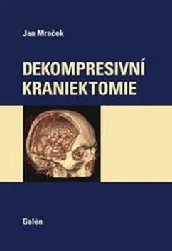 Medicína - ostatné Dekompresivní kraniektomie - Jan Mraček