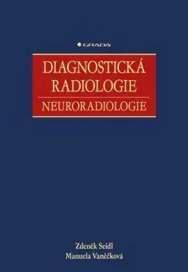 Medicína - ostatné Diagnostická radiologie - Zdeněk Seidl,Manuela Vaněčková
