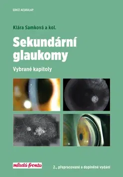 Medicína - ostatné Sekundární glaukomy - Kolektív autorov