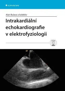 Medicína - ostatné Intrakardiální echokardiografie v elektrofyziologii - Alan Bulava,Kolektív autorov