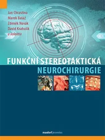 Medicína - ostatné Funkční stereotaktická neurochirurgie - Kolektív autorov