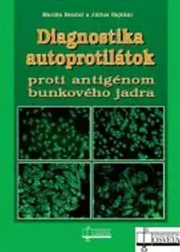 Medicína - ostatné Diagnostika autoprotilátok proti antigénom bunkové - Marián Benčat,Július Rajčáni