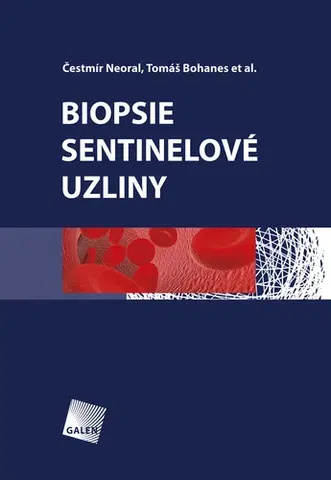 Medicína - ostatné Biopsie sentinelové uzliny - Čestmír Neoral,Tomáš Bohanes a kolektív
