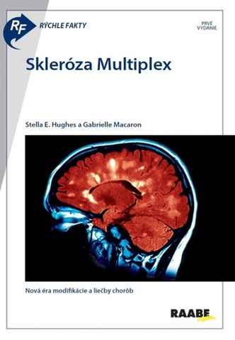 Medicína - ostatné Rýchle fakty : Skleróza multiplex - Kolektív autorov
