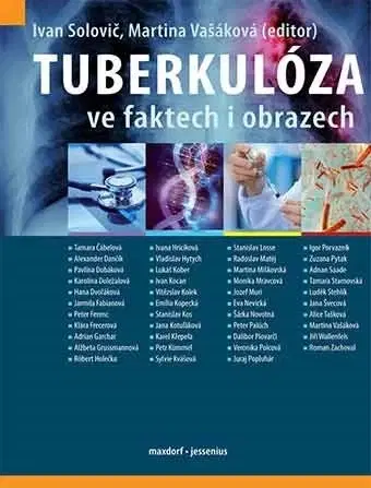 Medicína - ostatné Tuberkulóza ve faktech i obrazech - Ivan Solovič,Martina Vašáková