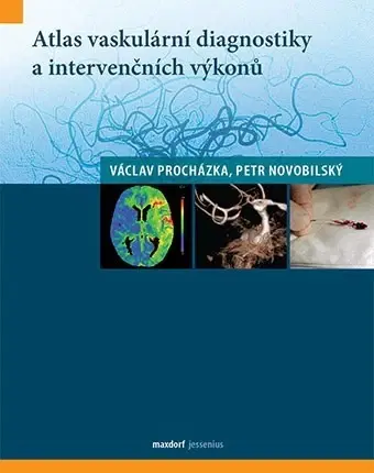 Medicína - ostatné Atlas vaskulární diagnostiky a intervenčních výkonů - Václav Procházka